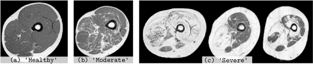 Figure 3 for An Asymetric Cycle-Consistency Loss for Dealing with Many-to-One Mappings in Image Translation: A Study on Thigh MR Scans