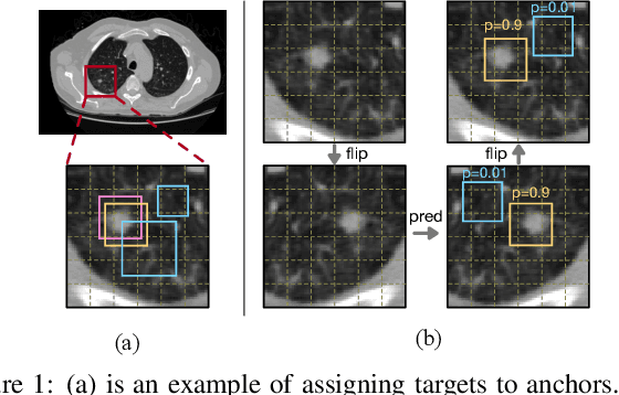 Figure 1 for FocalMix: Semi-Supervised Learning for 3D Medical Image Detection