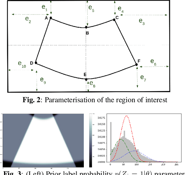 Figure 3 for Combining Bayesian and Deep Learning Methods for the Delineation of the Fan in Ultrasound Images