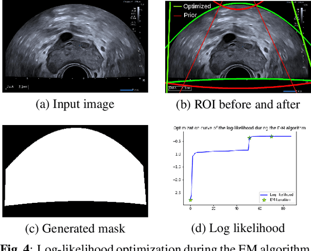 Figure 4 for Combining Bayesian and Deep Learning Methods for the Delineation of the Fan in Ultrasound Images
