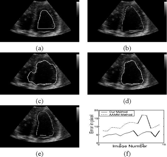 Figure 2 for Region-based active contour with noise and shape priors