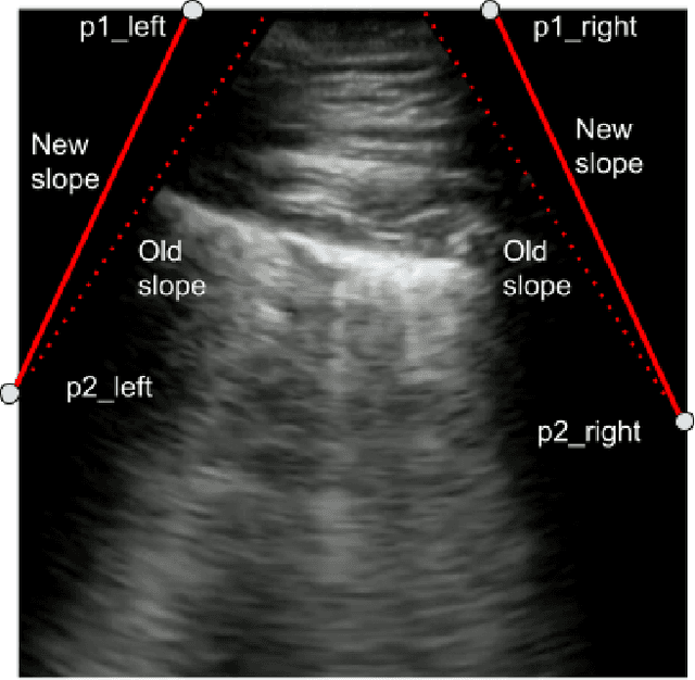 Figure 2 for COVID-Net US-X: Enhanced Deep Neural Network for Detection of COVID-19 Patient Cases from Convex Ultrasound Imaging Through Extended Linear-Convex Ultrasound Augmentation Learning