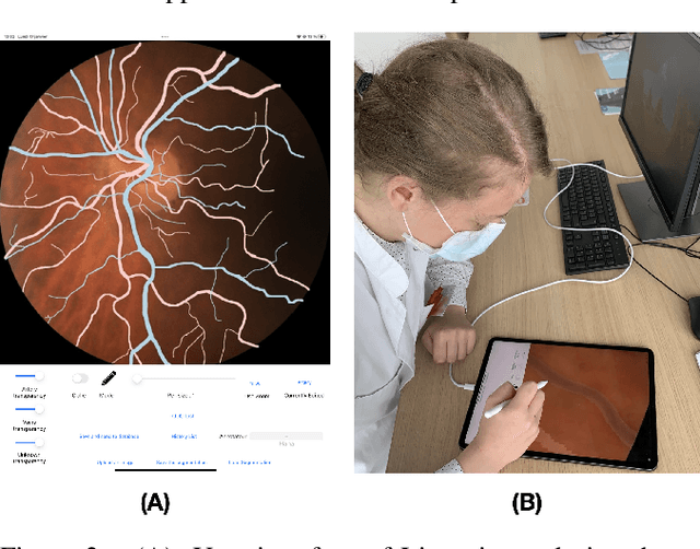 Figure 2 for Lirot.ai: A Novel Platform for Crowd-Sourcing Retinal Image Segmentations
