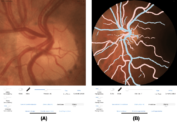 Figure 3 for Lirot.ai: A Novel Platform for Crowd-Sourcing Retinal Image Segmentations