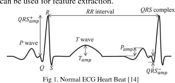 Figure 1 for Implementation of Neural Network and feature extraction to classify ECG signals