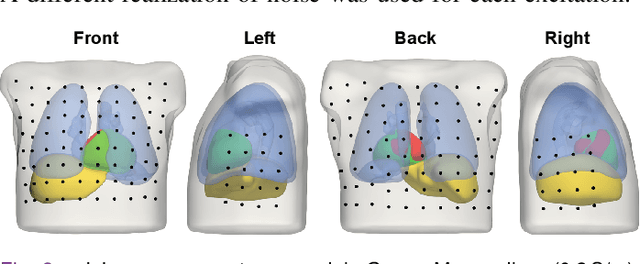 Figure 3 for Reducing Line-of-block Artifacts in Cardiac Activation Maps Estimated Using ECG Imaging: A Comparison of Source Models and Estimation Methods