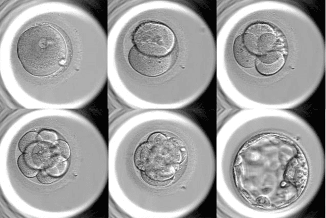 Figure 1 for Ethical Implementation of Artificial Intelligence to Select Embryos in In Vitro Fertilization