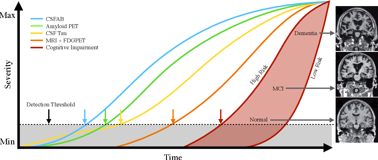 Figure 1 for DeepAD: A Robust Deep Learning Model of Alzheimer's Disease Progression for Real-World Clinical Applications