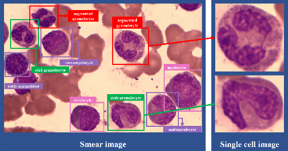 Figure 2 for Bone Marrow Cell Recognition: Training Deep Object Detection with A New Loss Function