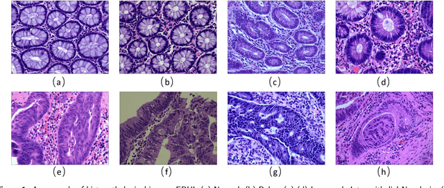 Figure 2 for EBHI:A New Enteroscope Biopsy Histopathological H&E Image Dataset for Image Classification Evaluation