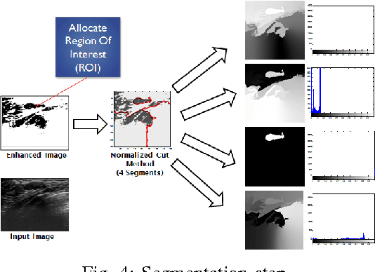 Figure 4 for Automated Breast Lesion Segmentation in Ultrasound Images