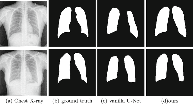 Figure 4 for Cascaded Robust Learning at Imperfect Labels for Chest X-ray Segmentation