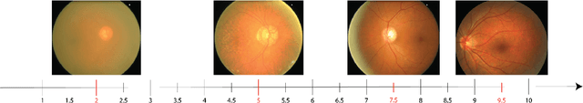 Figure 1 for FundusQ-Net: a Regression Quality Assessment Deep Learning Algorithm for Fundus Images Quality Grading