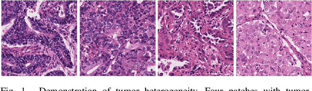 Figure 1 for Multi-Layer Pseudo-Supervision for Histopathology Tissue Semantic Segmentation using Patch-level Classification Labels