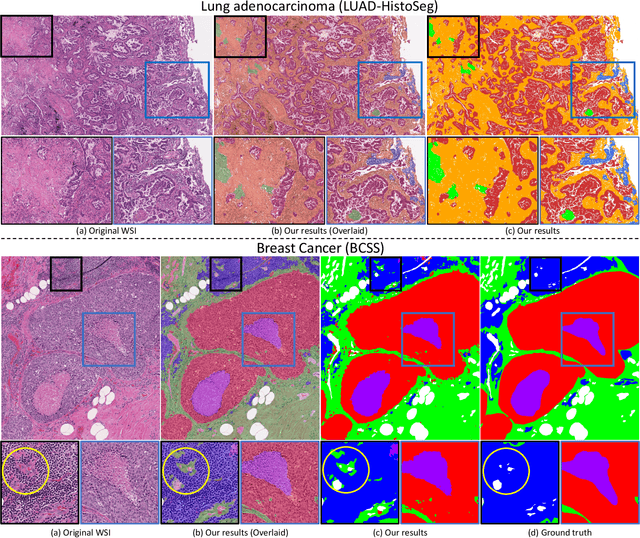 Figure 2 for Multi-Layer Pseudo-Supervision for Histopathology Tissue Semantic Segmentation using Patch-level Classification Labels