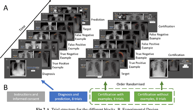Figure 2 for Explainable AI for medical imaging: Explaining pneumothorax diagnoses with Bayesian Teaching