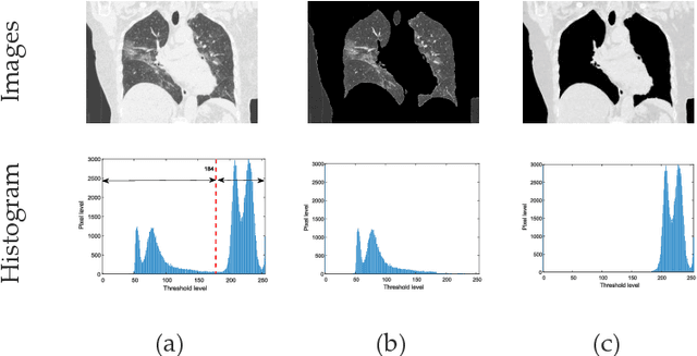 Figure 4 for Harmony-Search and Otsu based System for Coronavirus Disease (COVID-19) Detection using Lung CT Scan Images