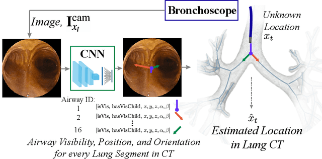 Figure 4 for Autonomous Driving in the Lung using Deep Learning for Localization
