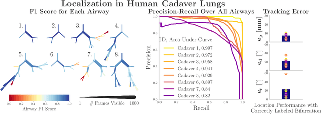 Figure 2 for Autonomous Driving in the Lung using Deep Learning for Localization