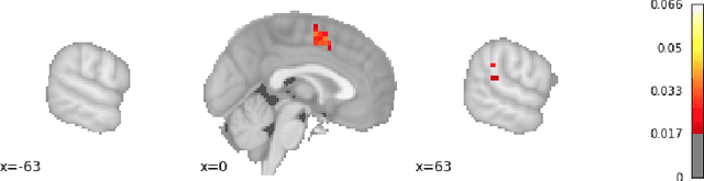 Figure 3 for Scalable Query Answering under Uncertainty to Neuroscientific Ontological Knowledge: The NeuroLang Approach