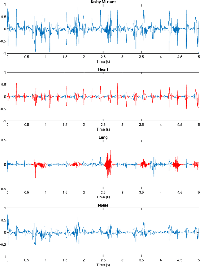 Figure 2 for A New Non-Negative Matrix Co-Factorisation Approach for Noisy Neonatal Chest Sound Separation