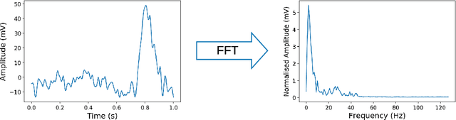 Figure 4 for Disguising Personal Identity Information in EEG Signals