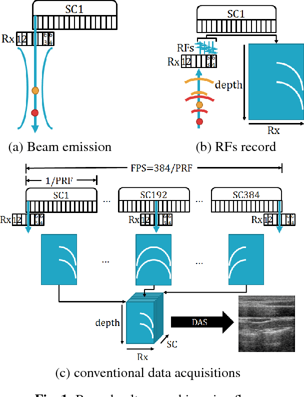 Figure 1 for Deep Learning for Accelerated Ultrasound Imaging