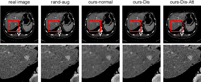 Figure 3 for Inter-slice image augmentation based on frame interpolation for boosting medical image segmentation accuracy