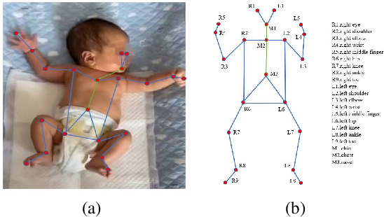 Figure 1 for AggPose: Deep Aggregation Vision Transformer for Infant Pose Estimation