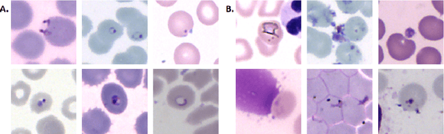 Figure 2 for Fully-automated patient-level malaria assessment on field-prepared thin blood film microscopy images, including Supplementary Information