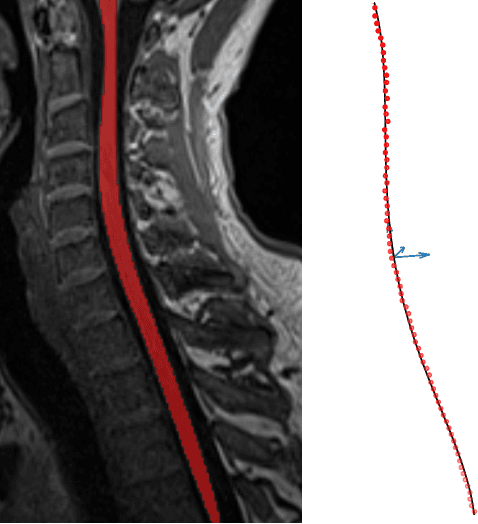 Figure 1 for Evaluation of distortion correction methods in diffusion MRI of the spinal cord