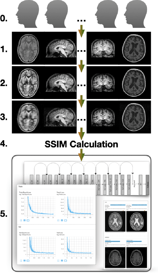 Figure 1 for Automated SSIM Regression for Detection and Quantification of Motion Artefacts in Brain MR Images