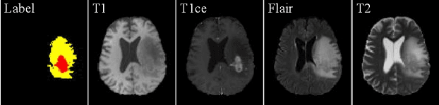 Figure 1 for Learning Multi-Modal Brain Tumor Segmentation from Privileged Semi-Paired MRI Images with Curriculum Disentanglement Learning