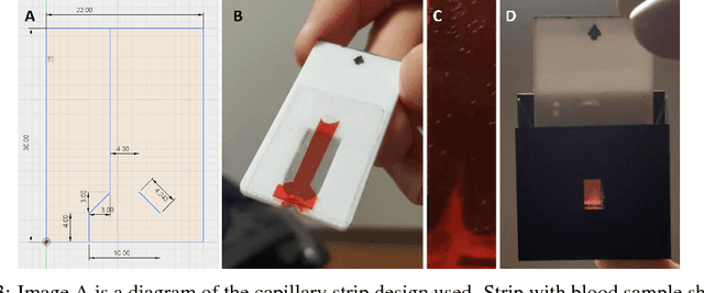 Figure 3 for Rapid point-of-care Hemoglobin measurement through low-cost optics and Convolutional Neural Network based validation