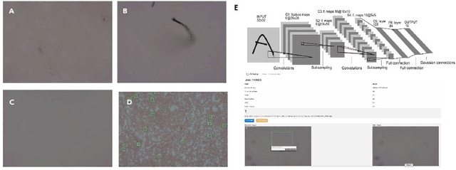 Figure 4 for Rapid point-of-care Hemoglobin measurement through low-cost optics and Convolutional Neural Network based validation