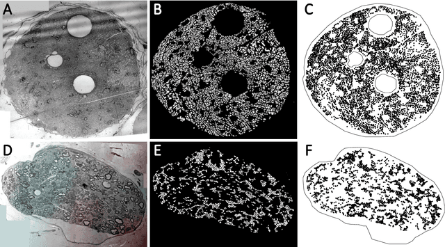 Figure 3 for A novel statistical methodology for quantifying the spatial arrangements of axons in peripheral nerves