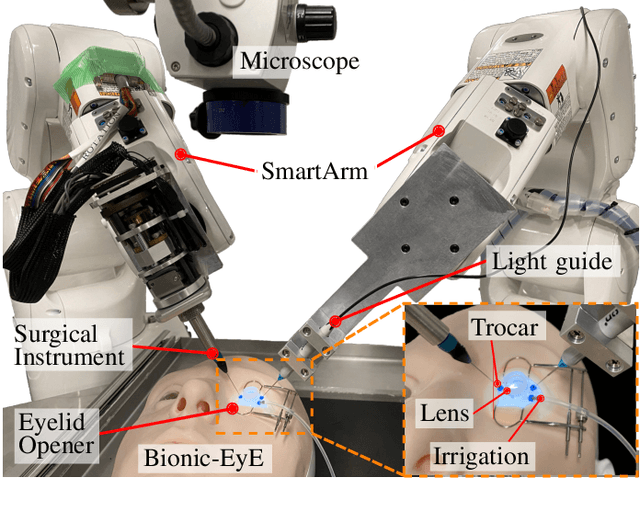 Figure 1 for Autonomous Coordinated Control of the Light Guide for Positioning in Vitreoretinal Surgery