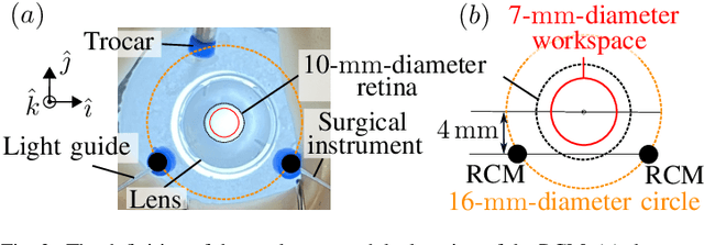 Figure 2 for Autonomous Coordinated Control of the Light Guide for Positioning in Vitreoretinal Surgery