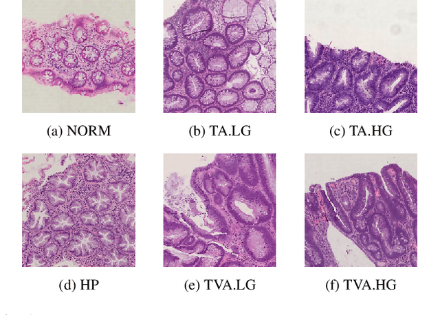 Figure 2 for UniToPatho, a labeled histopathological dataset for colorectal polyps classification and adenoma dysplasia grading