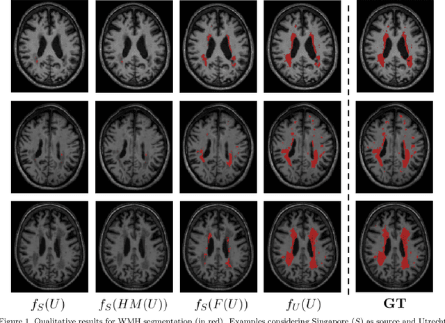 Figure 1 for Unsupervised Domain Adaptation via CycleGAN for White Matter Hyperintensity Segmentation in Multicenter MR Images