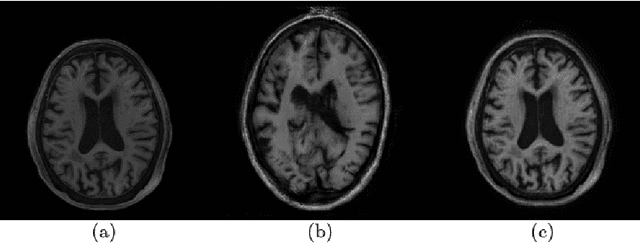 Figure 3 for Unsupervised Domain Adaptation via CycleGAN for White Matter Hyperintensity Segmentation in Multicenter MR Images