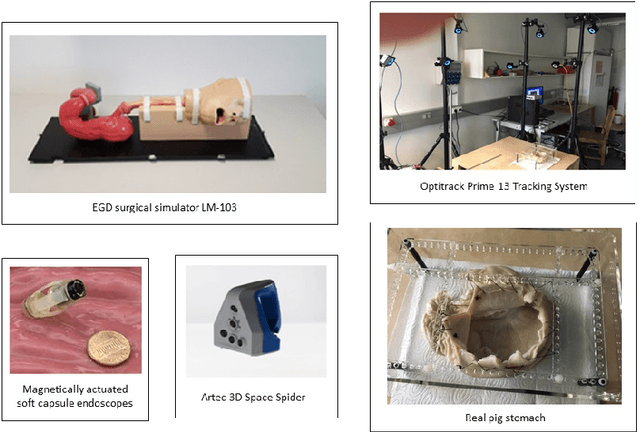 Figure 1 for Sparse-then-Dense Alignment based 3D Map Reconstruction Method for Endoscopic Capsule Robots