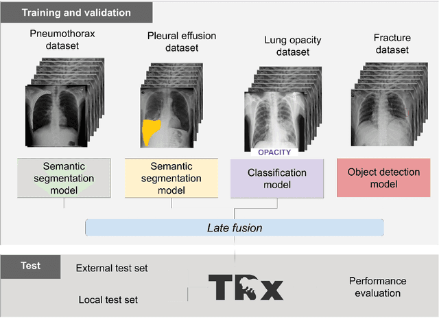 Figure 1 for Chest x-ray automated triage: a semiologic approach designed for clinical implementation, exploiting different types of labels through a combination of four Deep Learning architectures