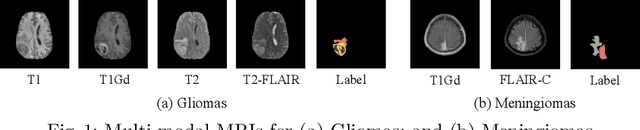Figure 1 for NestedFormer: Nested Modality-Aware Transformer for Brain Tumor Segmentation
