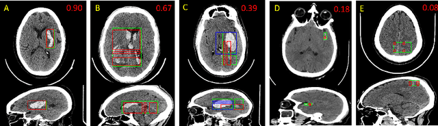 Figure 3 for Localization and classification of intracranialhemorrhages in CT data