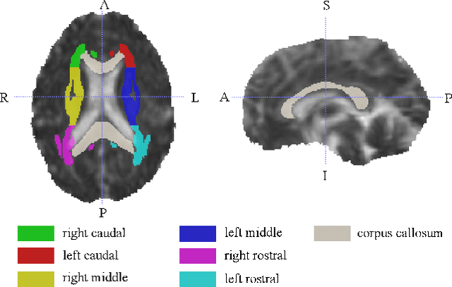 Figure 1 for Identification of relevant diffusion MRI metrics impacting cognitive functions using a novel feature selection method