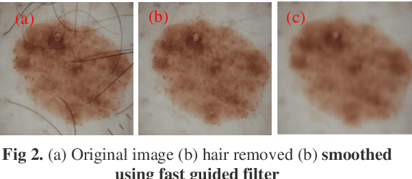 Figure 3 for Frequency and Spatial domain based Saliency for Pigmented Skin Lesion Segmentation