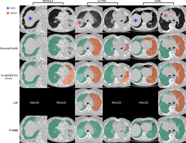 Figure 2 for Automatic lung segmentation in routine imaging is a data diversity problem, not a methodology problem