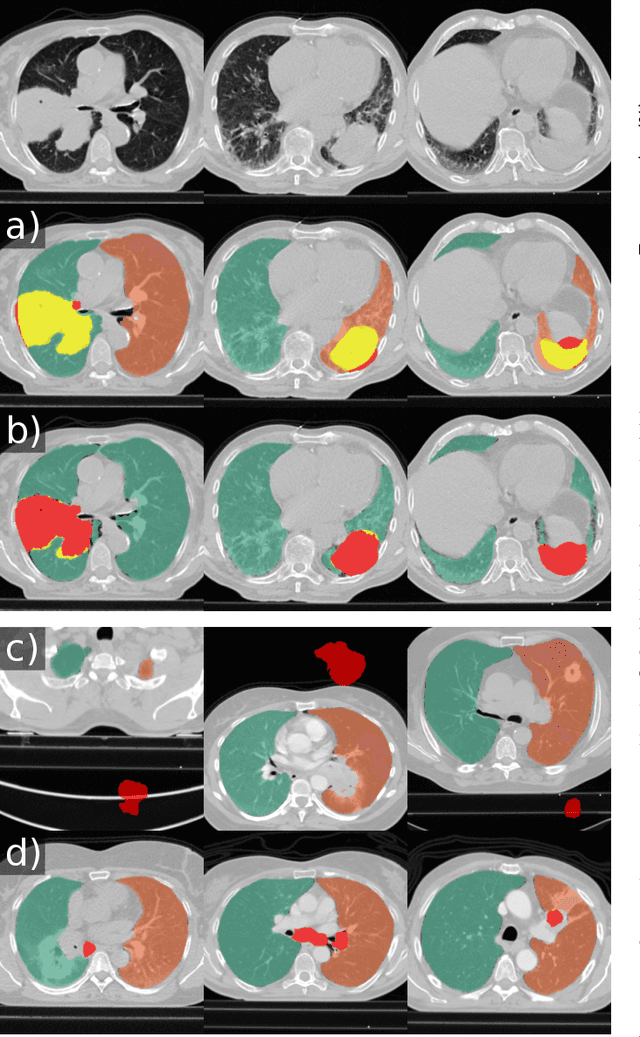 Figure 3 for Automatic lung segmentation in routine imaging is a data diversity problem, not a methodology problem
