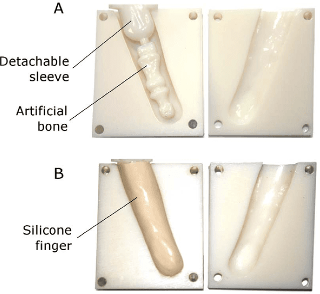 Figure 4 for Patient-Specific Prosthetic Fingers by Remote Collaboration - A Case Study